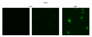 tcpspost