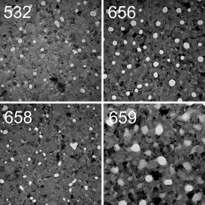 tem-micrographs