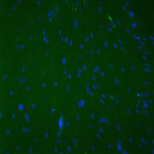10-stain-1c