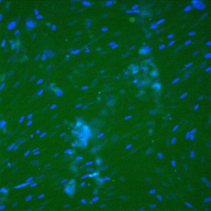 12-stain-1c