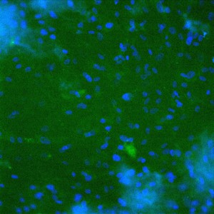 4-stain-1c - Copy