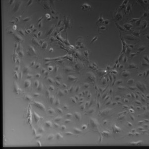 D4-5 Gel SiO2 1-2