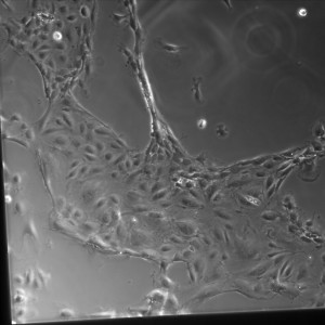 D7-5 Gel SiO2 2-2