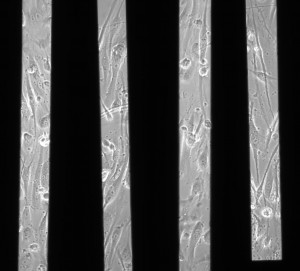 4 different images of HUVECs