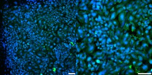 Gel Low SiO2 Combined