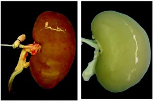 Song(Ott)_2013_decell pig kidney
