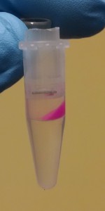 Aggregated 20 nm NPs and IgG