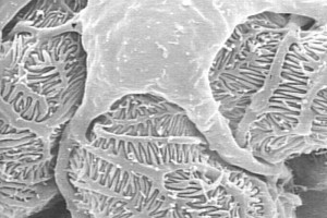 Podocytes
