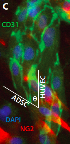 ADSC-NG2-Alignment