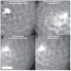 Angiogensis Images