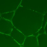 5000 cells on membrane in 10 uL Geltrex