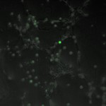 4,000 HUVEC cells, 400  ADSC cells at time of ADSC seeding (ADSC stained with 1 uM  CMFDA)