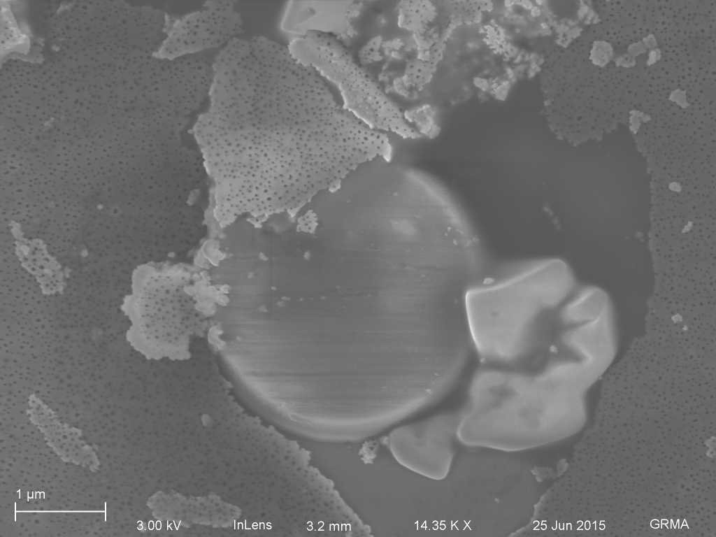 Broken post. The tented radius is about 1.5 microns.