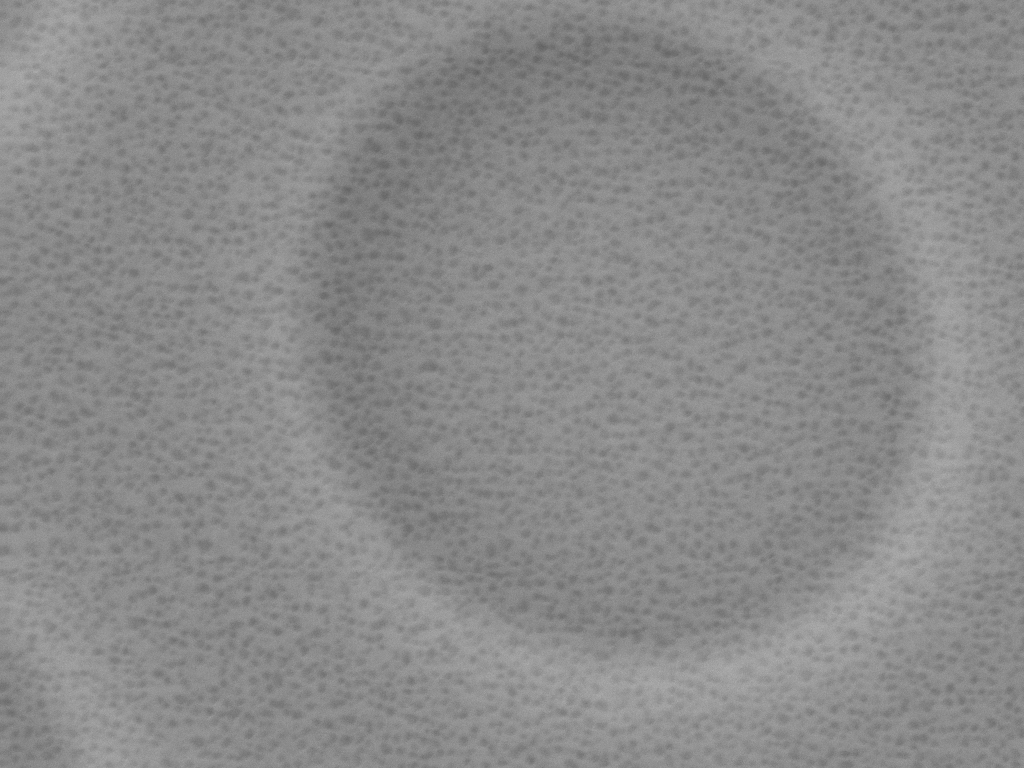 Close up view, no nanoparticles to be seen