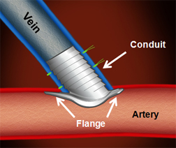 Optiflow