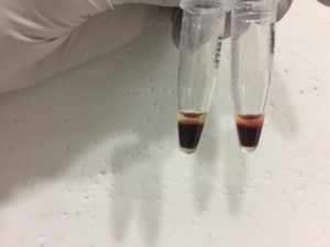 possible-rbc-lysis-in-cellulose-sample