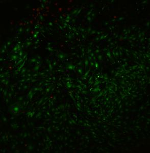 pncsi2_overlay