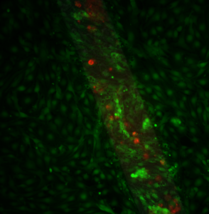pncSi4(bEndstain)